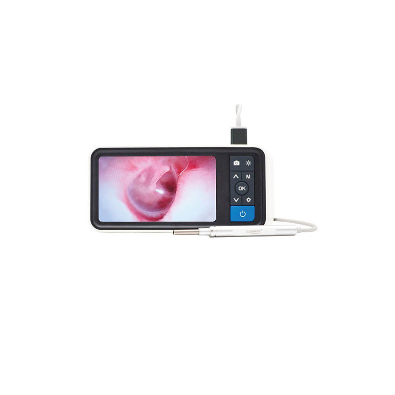 CAMÉRA ENDOSCOPIQUE